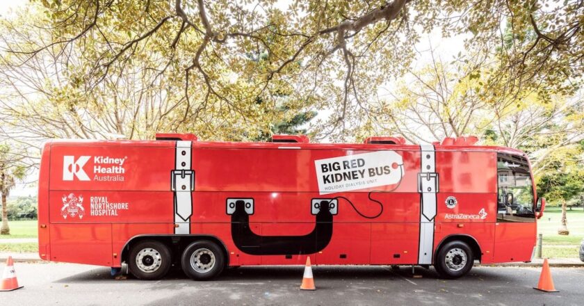 big red kidney bus